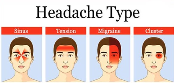 Headache Investigations And Management Clinic