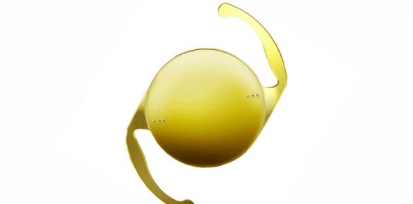 Toric Lenses
