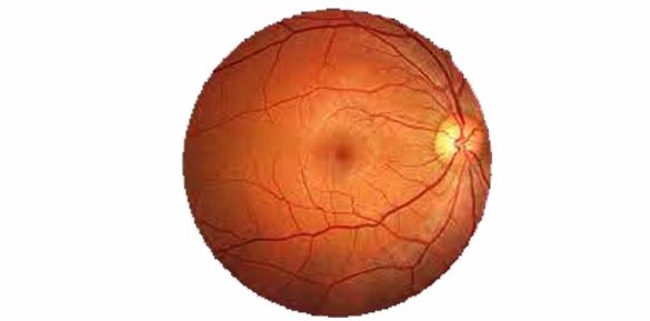 Medical Retina